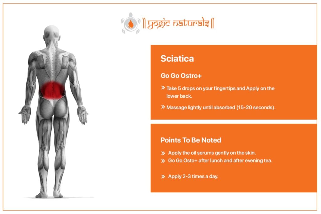 Sciatica